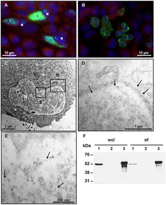 The Putative Type III Secreted Chlamydia abortus Virulence-Associated Protein CAB063 Targets Lamin and Induces Apoptosis